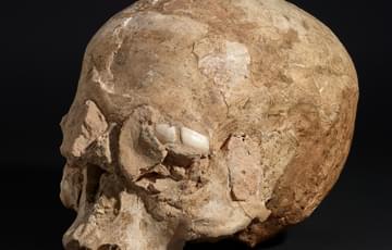 Human skull with the eye and nose cavities filled with plaster and small stones